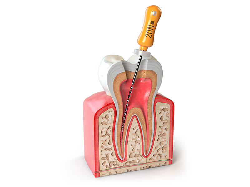 Endodontia